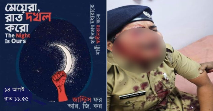 The female police officer who was affected by night occupation, wasn't the night a shampa